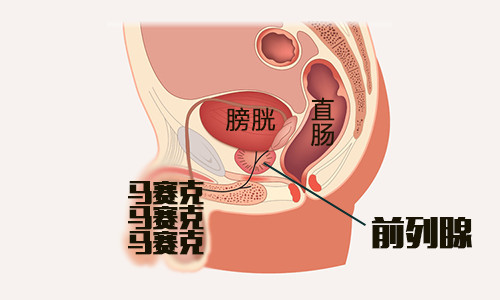 前列腺不舒服会引起这么大的问题，作为男人你竟然还不知道？